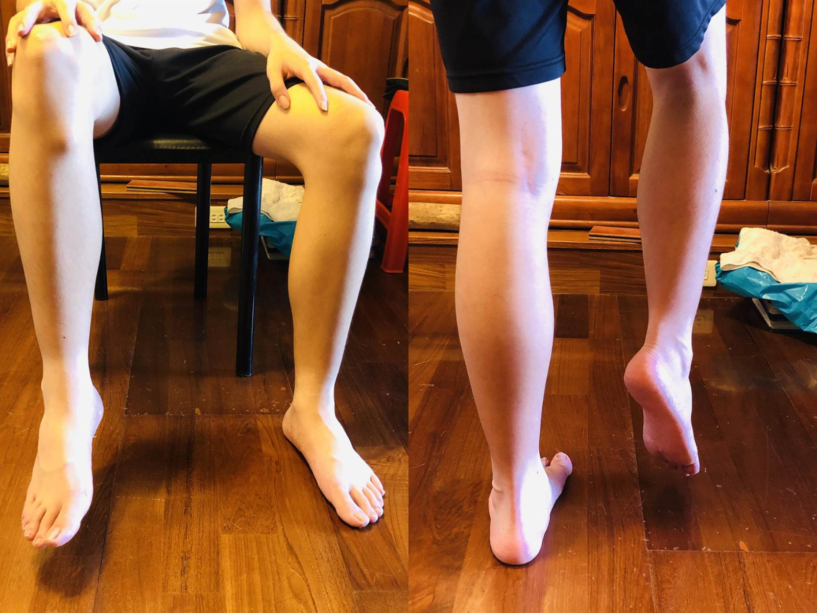 停課不停學少年腳不能抬　原來因為每日都翹腳上網